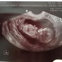 ¡futuras mamis noviembre 2016! - 1