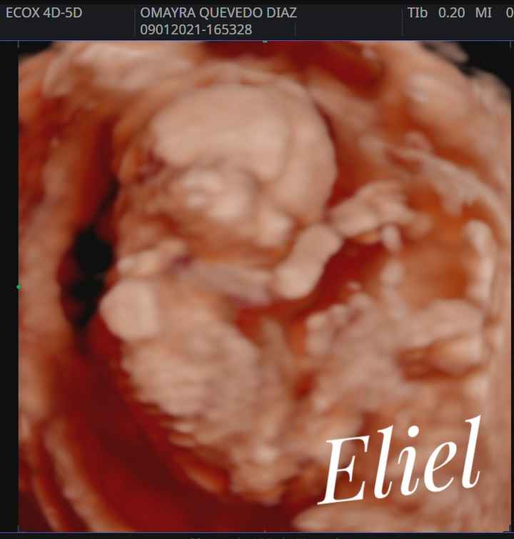 Futuras mamis junio 2021 🤰🏻❤️ oficial - 1