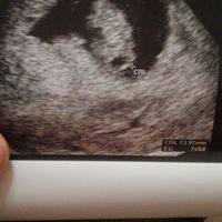 Futuras mamis junio 2021 🤰🏻❤️ oficial - 1