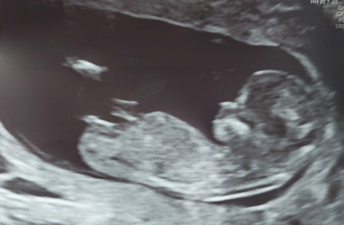 Futuras mamis Junio 2023 - 1
