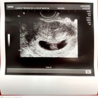 Futuras mamis Febrero 2021 - 1