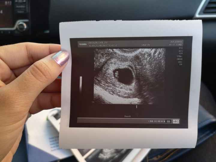 Semana 6+2