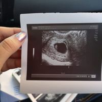 Semana 6+2