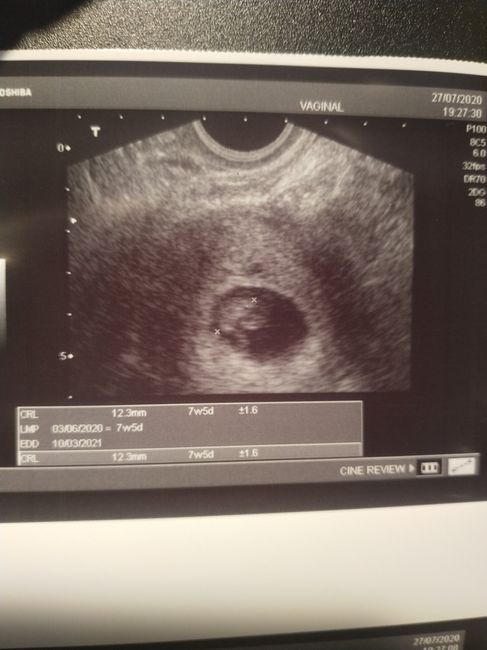 Futuras mamis Marzo 2021 ❤️❤️ - 1