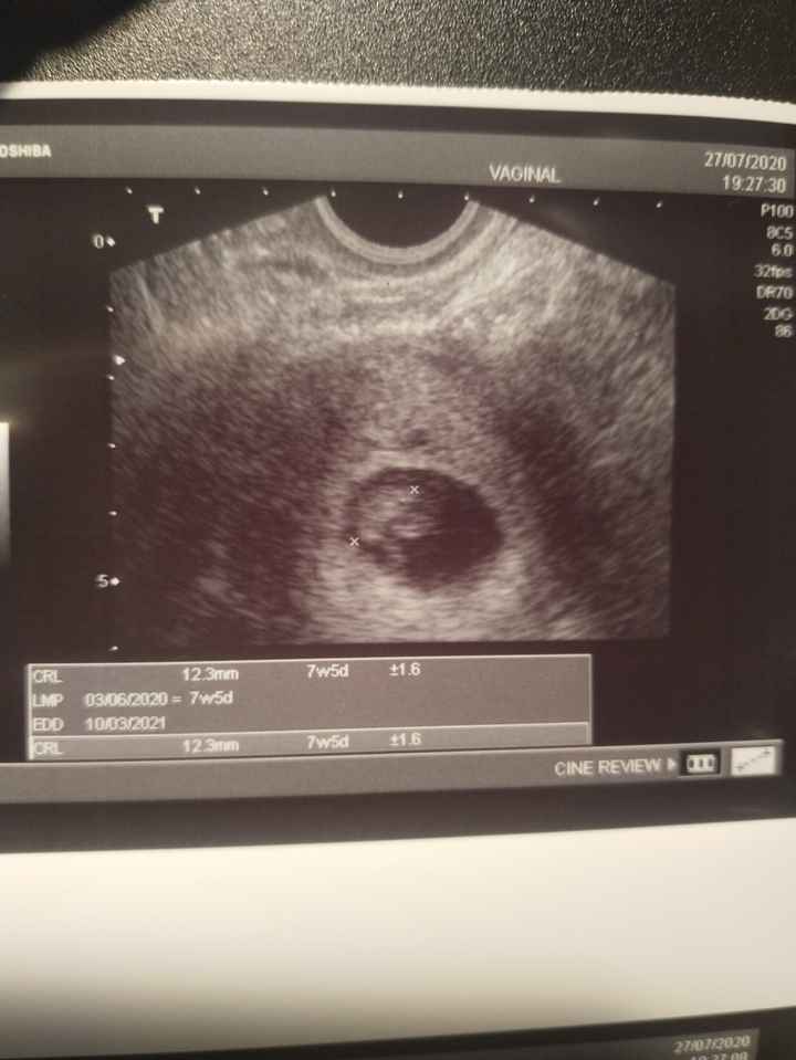 Futuras mamis Marzo 2021 ❤️❤️ 3