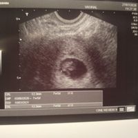 Futuras mamis Marzo 2021 ❤️❤️ - 1