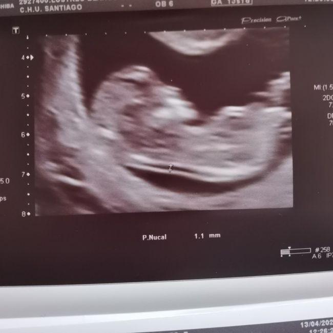 Futuras mamas Diciembre 2020 2