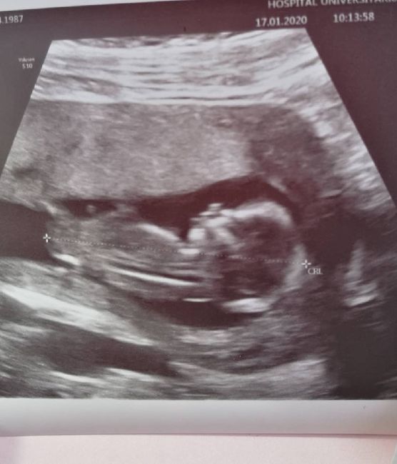 Futuras Mamas Julio 2020. - 1
