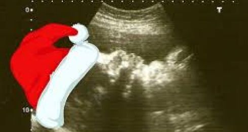 Felices fiestas