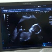 Mamis marzo 2016 - 1