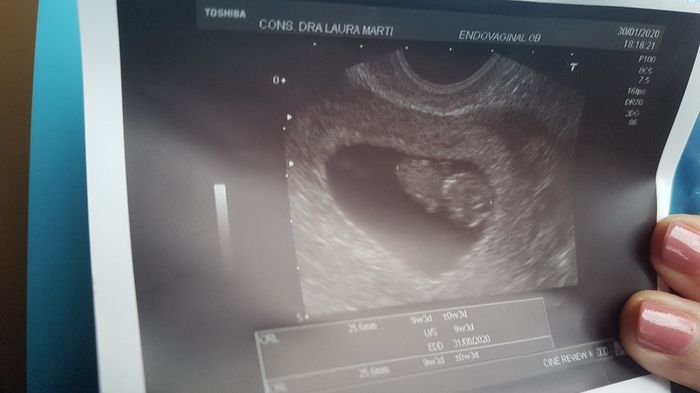 Ayuda con método ramzi: niño o niña? - 1
