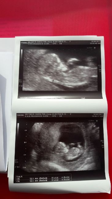 ¡nuevo! futuras mamis marzo 2018 - 1