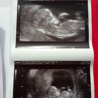 ¡nuevo! futuras mamis marzo 2018 - 1