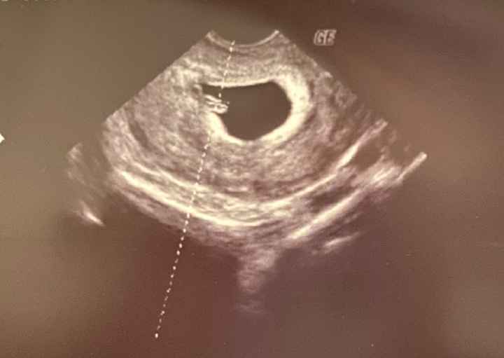 Futuras mamis Junio 2023 - 1