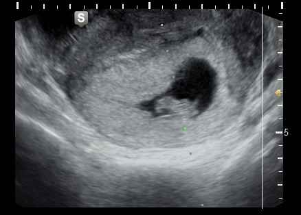 Futuras mamis Junio 2023 - 1