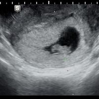 Futuras mamis Junio 2023 - 1