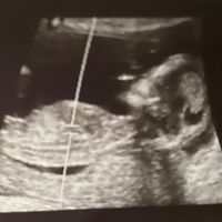 El consultorio de Lita para futuras mamis - 1