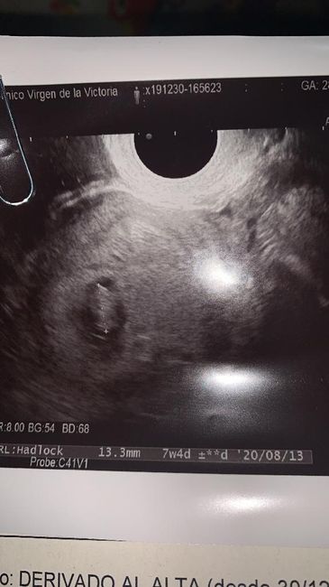 Ayuda con método ramzi: niño o niña? - 1
