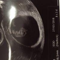 Futuras mamás Octubre 2018!!! - 2