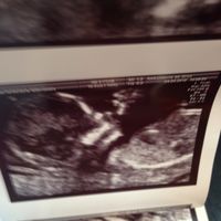 Futuras mamás Octubre 2018!!! - 1