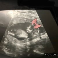 Futuras mamás Junio 2020 - 1