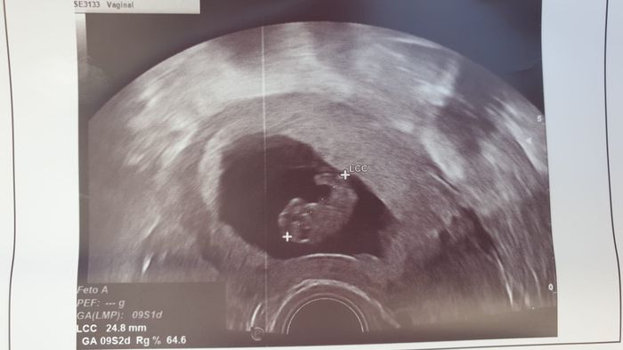 Futuras mamis Enero 2022 - 1
