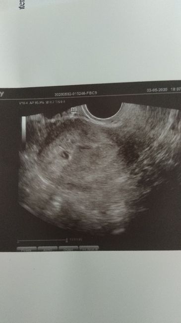 Futuras mamas Diciembre 2020 - 1