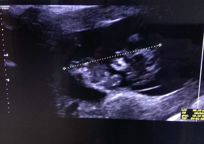 Futuras mamas Diciembre 2020 - 1