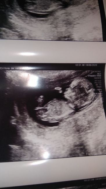 Futuras mamas Diciembre 2020 - 1