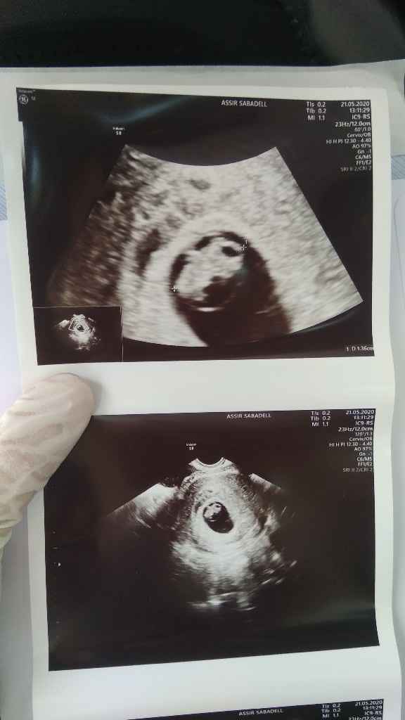 Futuras mamas Diciembre 2020 - 1