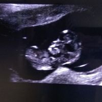 Futuras mamas Diciembre 2020 - 2