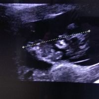 Futuras Mamis Enero 2021 - 1