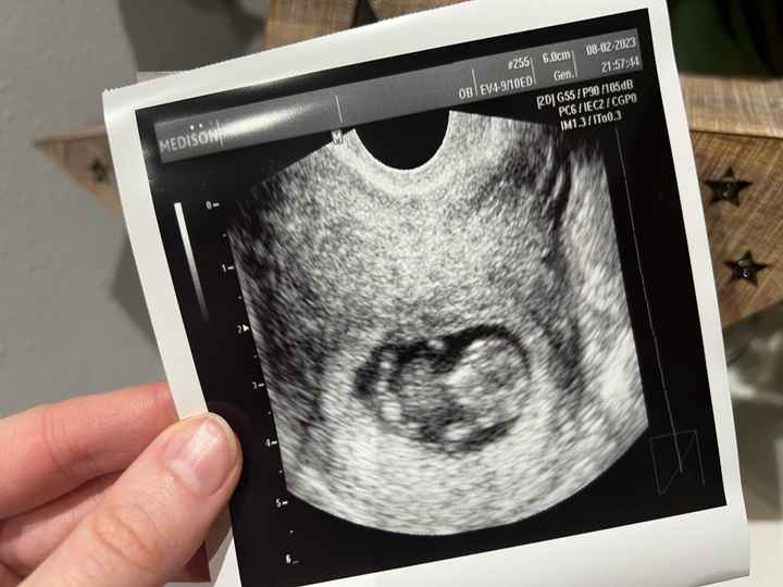 Futuras mamás septiembre 2023?? - 1