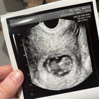 Futuras mamás septiembre 2023?? - 1