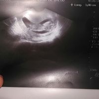  Futuras mamás agosto 2018 - 1