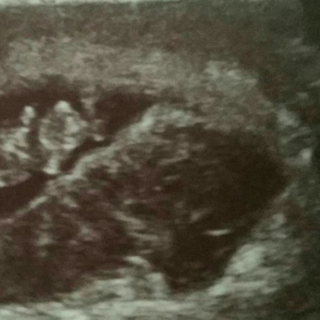 Futuras mamas Diciembre 2020 1