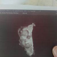 Futuras Mamis Enero 2021 - 1