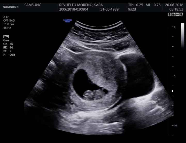 Futuras mamás enero 2019 - 1
