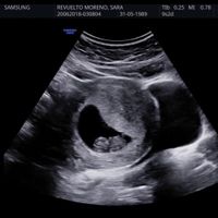Futuras mamás enero 2019 - 1