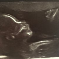 Futuras mamás enero 2019 - 1