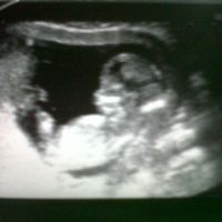 Mi bebé de 12 5