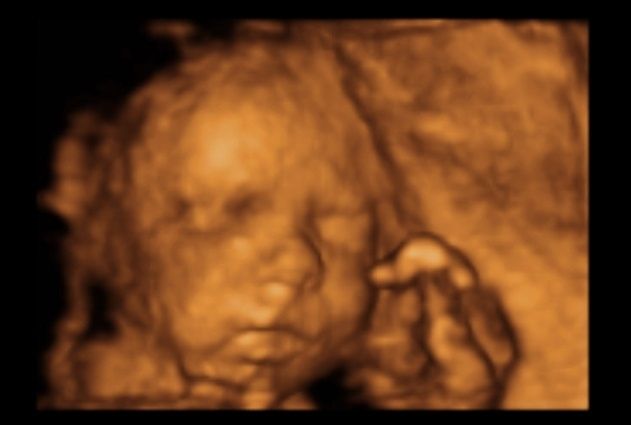 Mi peque de 27 semanas!