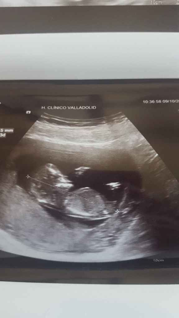  Futuras mamás Abril de 2018! - 1