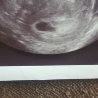 Metodo saad ramzi para saber el sexo del bebe - 1