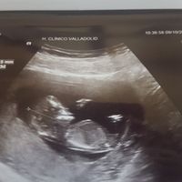  Niño o niña? - 1