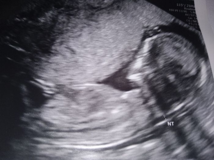 Futuras mamas julio 2019 - 1