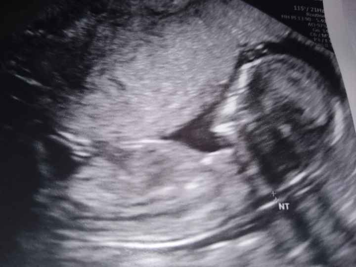 Futuras mamas julio 2019 - 1