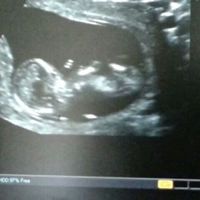 El consultorio de Lita para futuras mamis - 2