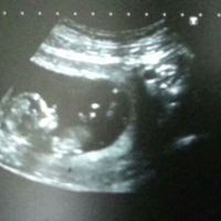 El consultorio de Lita para futuras mamis - 3