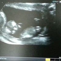 El consultorio de Lita para futuras mamis - 4